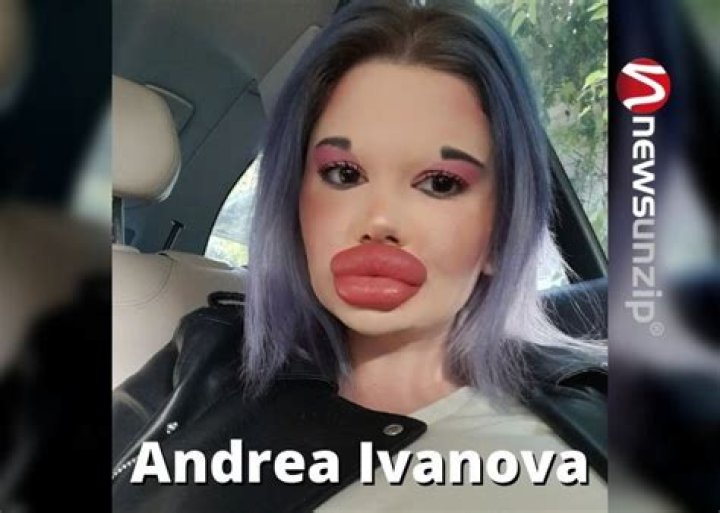 Andrea Ivanova [Biggest Lips] Wiki, Biography, Surgery, Age, Boyfriend, Net Worth, Family, Height & More
