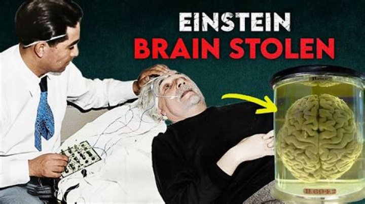 How Albert Einstein's Brain Was Stolen After His Death